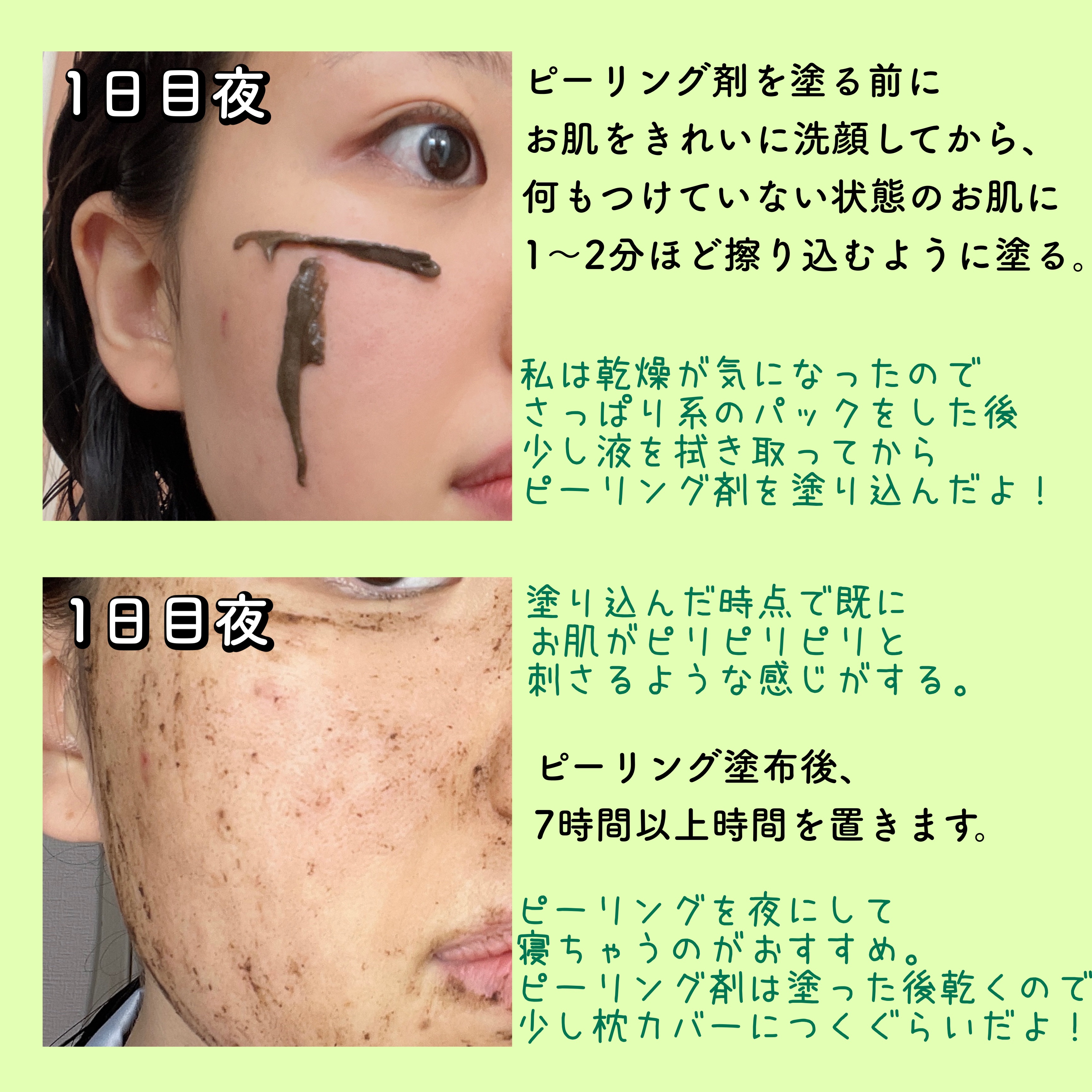 on:my skin ハーブピーリング on: myskin オンマイスキン ハーブ