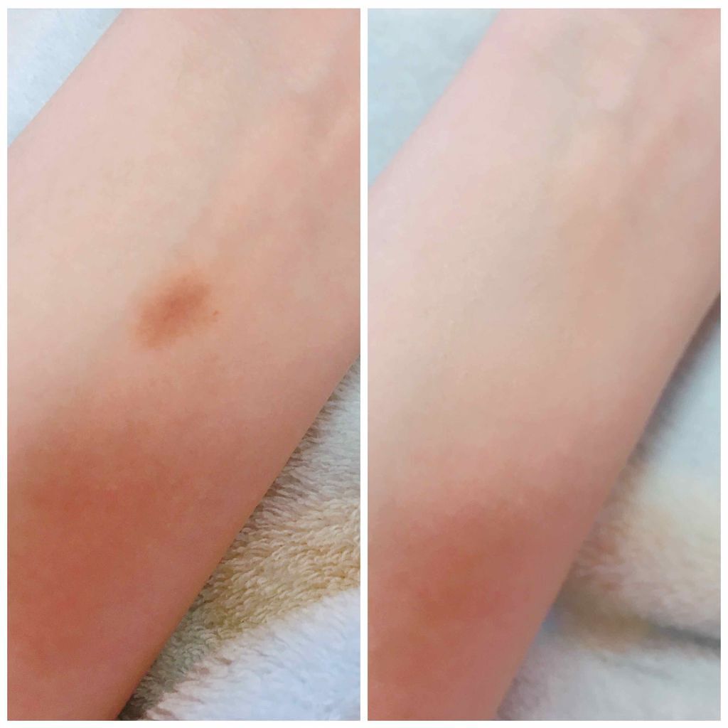 カバーパーフェクション チップコンシーラー/the SAEM/リキッドコンシーラーを使ったクチコミ（3枚目）