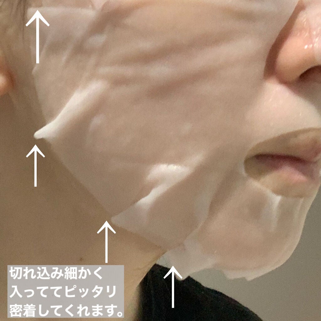 SUIKO HC ビタミン5エッセンスマスク/SUIKO HATSUCURE/シートマスク・パックを使ったクチコミ(8枚目)