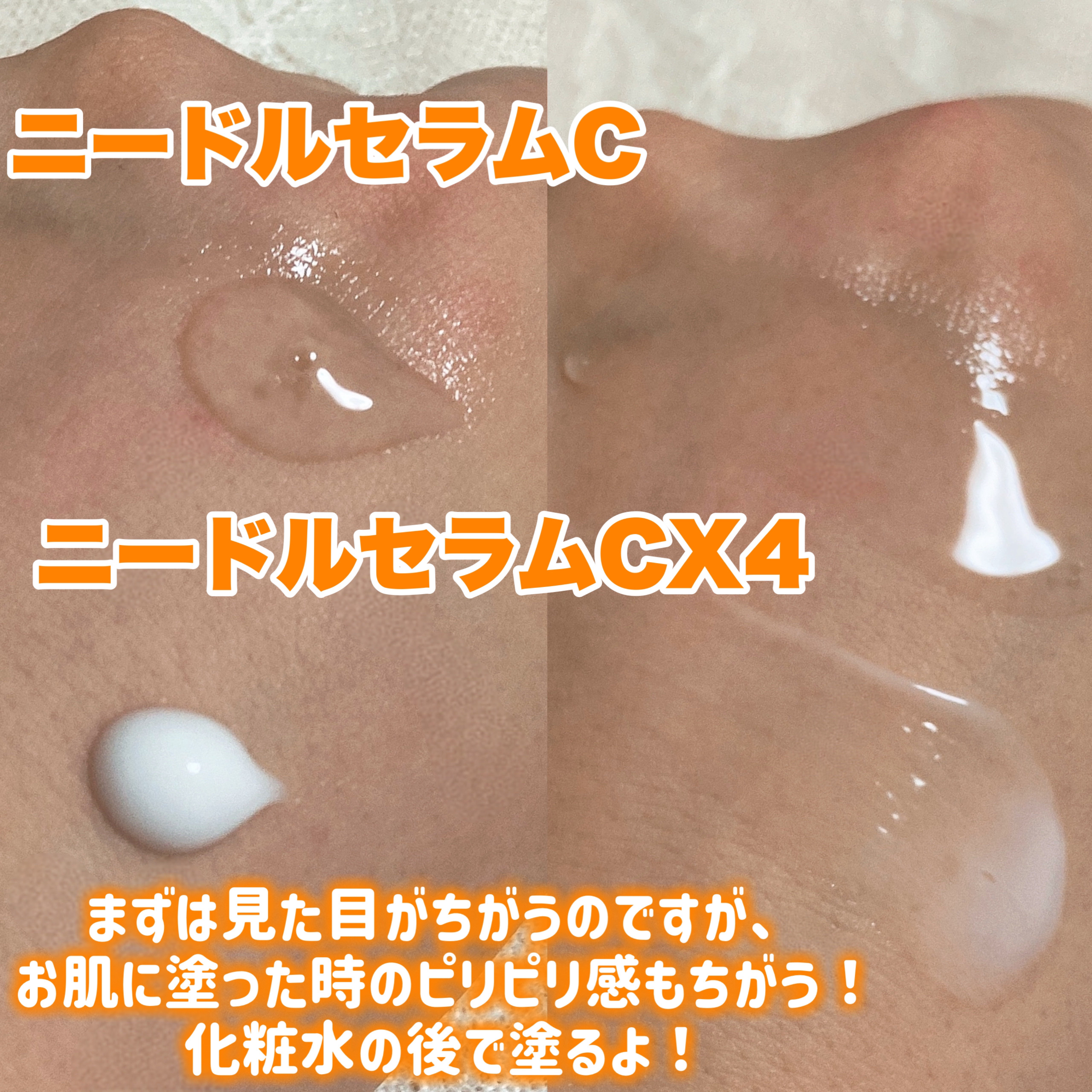 ニードルセラムCX4/fractionalCC/美容液を使ったクチコミ（2枚目）