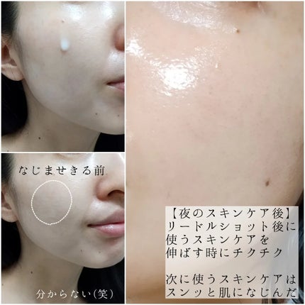 マイルドリードルショット50/VT/美容液を使ったクチコミ(5枚目)