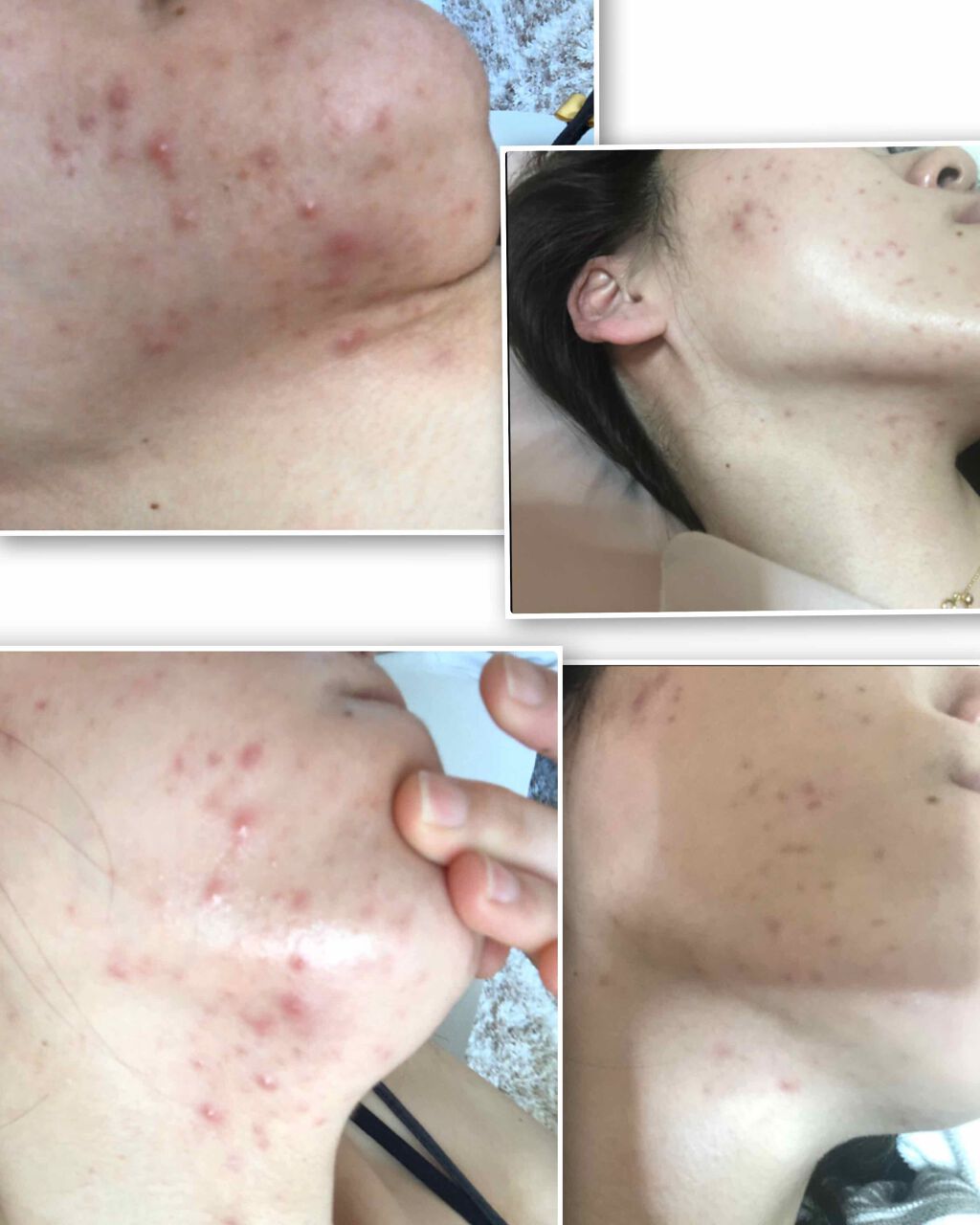 ハトムギ化粧水(ナチュリエ スキンコンディショナー R )/ナチュリエ/化粧水を使ったクチコミ(3枚目)