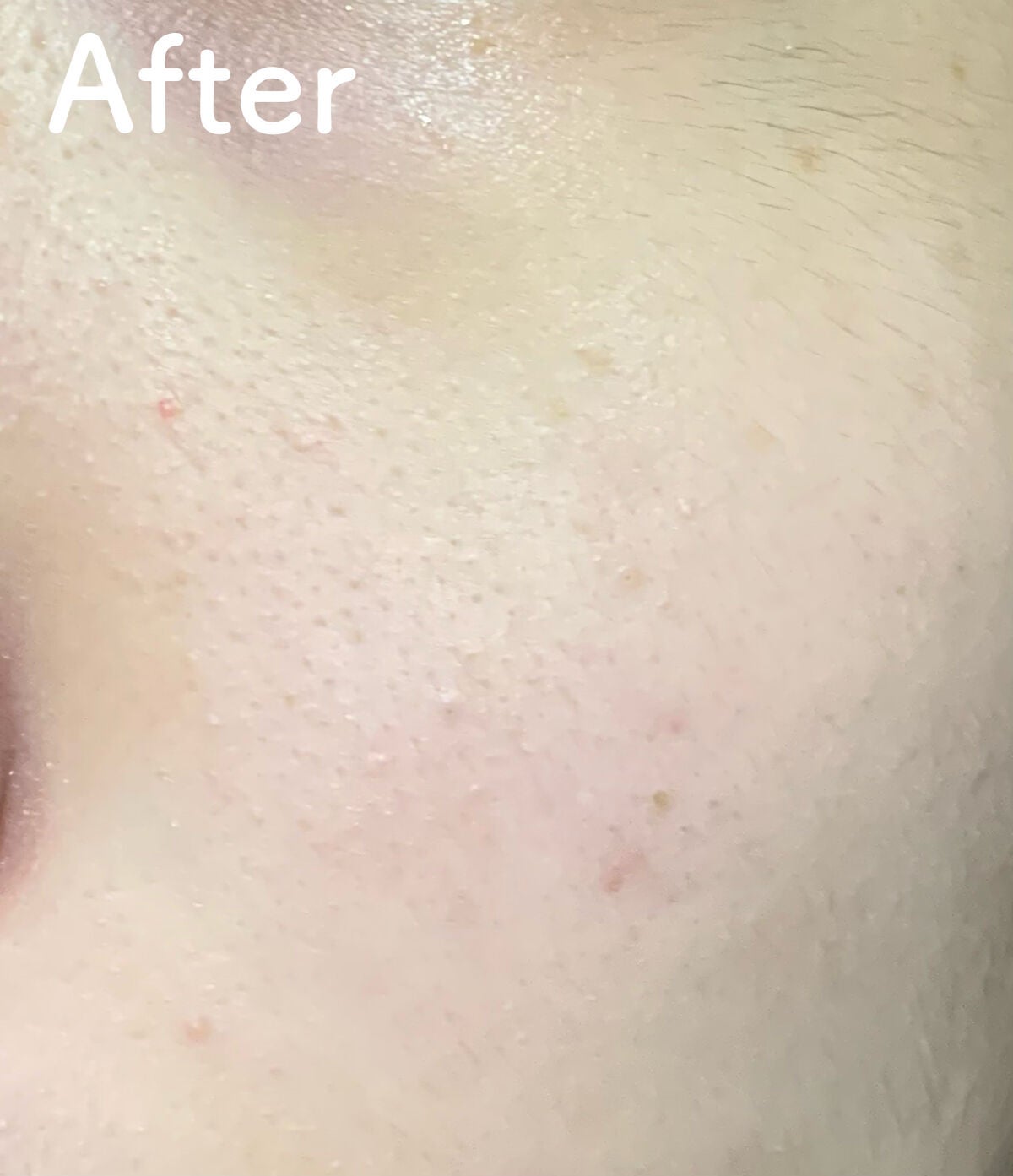 ももぷり フレッシュバブルパック/ももぷり/洗い流すパック・マスクを使ったクチコミ(6枚目)