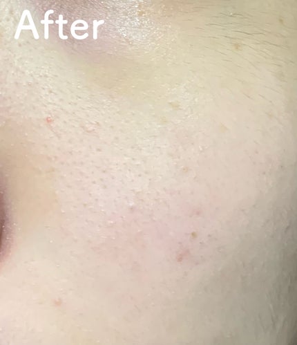 ももぷり フレッシュバブルパック/ももぷり/洗い流すパック・マスクを使ったクチコミ(6枚目)