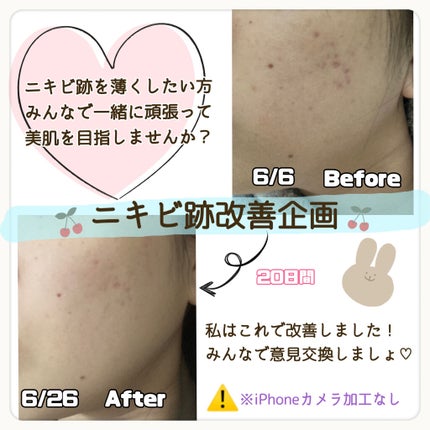 薬用しみ集中対策 プレミアム美容液/メラノCC/美容液を使ったクチコミ(1枚目)