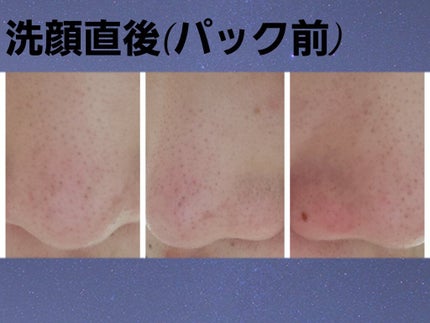 オードムーゲ 薬用ローション(ふきとり化粧水)/オードムーゲ/拭き取り化粧水を使ったクチコミ(4枚目)