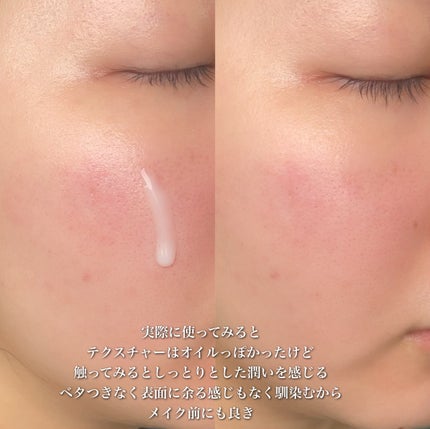 サミュ PHセンシティブフェイシャルトリートメント/SAM'U/美容液を使ったクチコミ(6枚目)