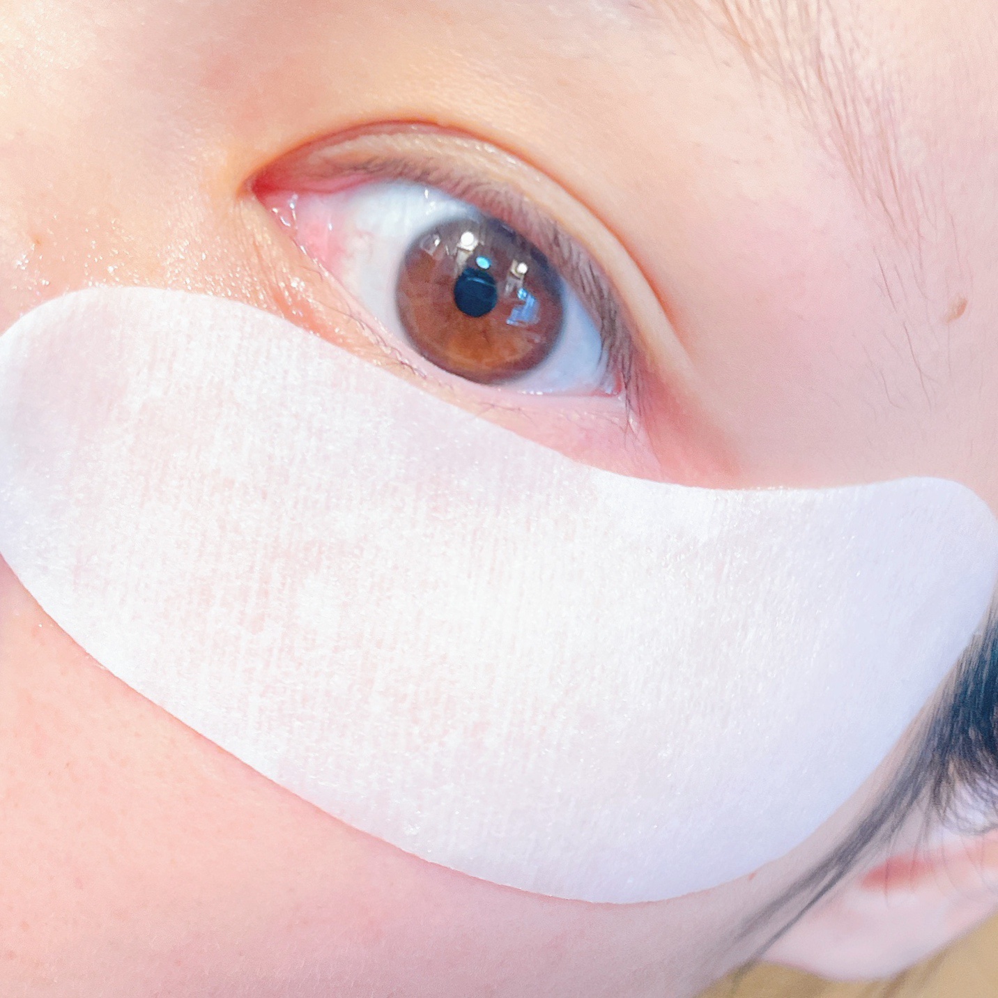 ダーマレーザー アイシート スーパーVCR/クオリティファースト/アイケア・アイクリームを使ったクチコミ（3枚目）