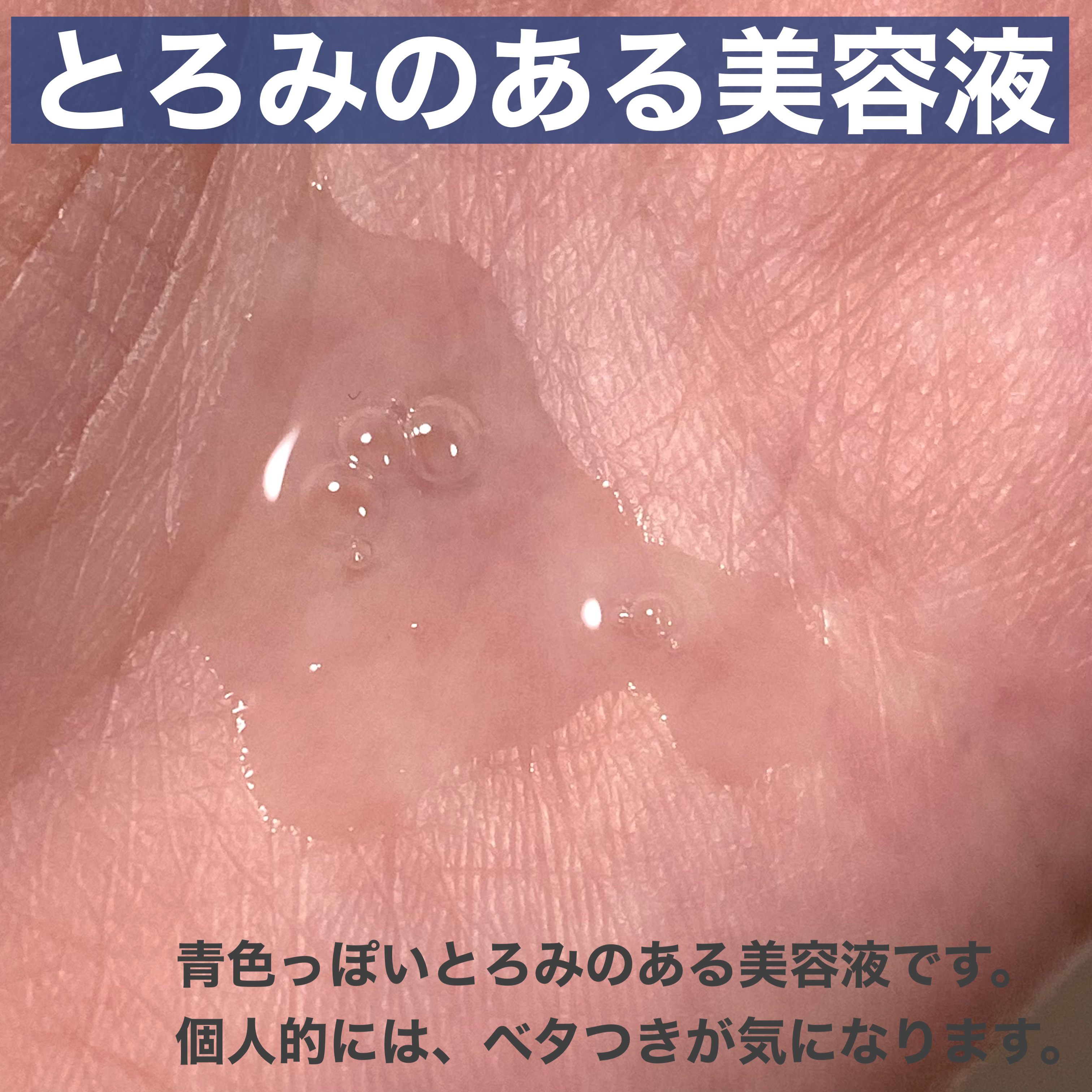 ゼロ毛穴1DAYセラム/MEDICUBE/美容液を使ったクチコミ（3枚目）