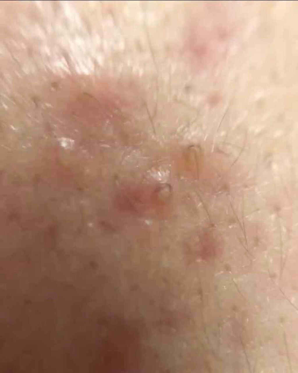 薬用保湿化粧水/オードムーゲ/化粧水を使ったクチコミ(7枚目)