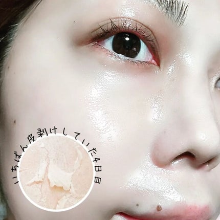 ダーマスキンピーリング/BQCELL/その他キットセットを使ったクチコミ(4枚目)