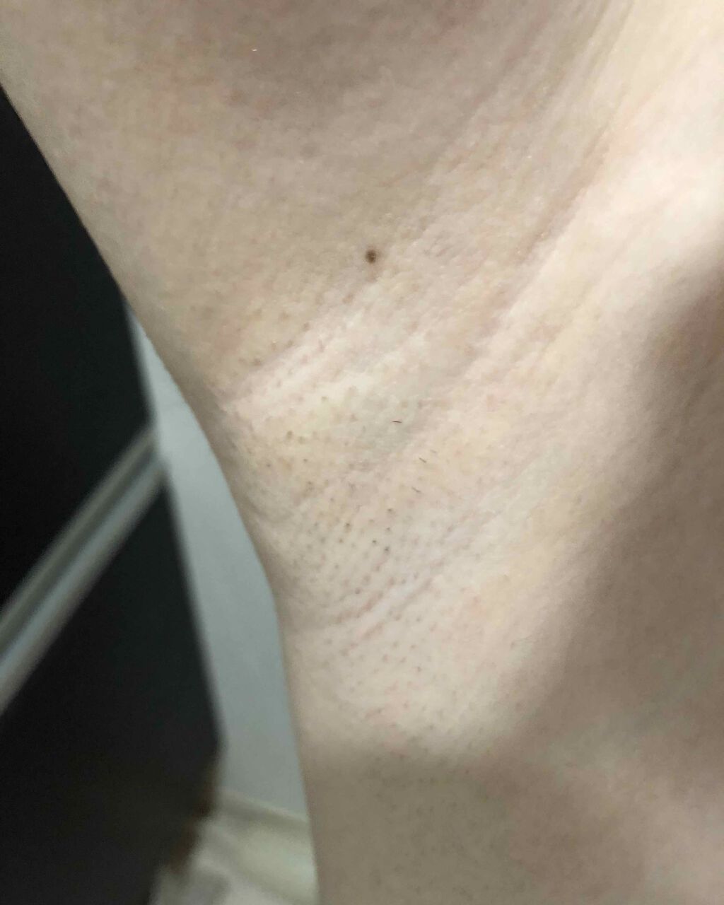 スムーズスキンbare plus/スムーズスキン/家庭用脱毛器を使ったクチコミ(2枚目)