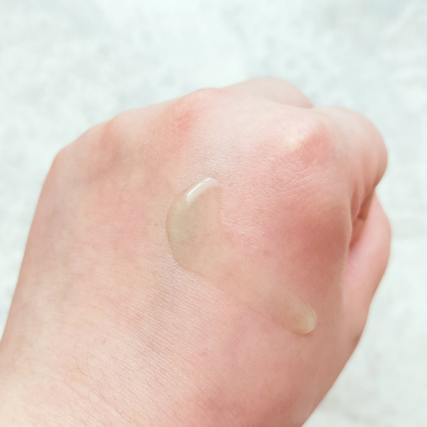 アゼライン酸15 インテンスカーミングセラム/Anua/美容液を使ったクチコミ(4枚目)