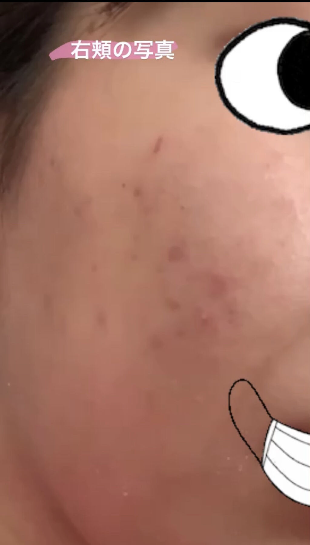 薬用 しみ 集中対策 美容液/メラノCC/美容液を使ったクチコミ（3枚目）