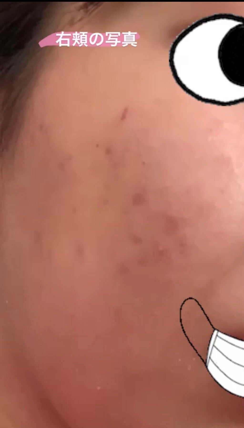 薬用 しみ 集中対策 美容液/メラノCC/美容液を使ったクチコミ(3枚目)