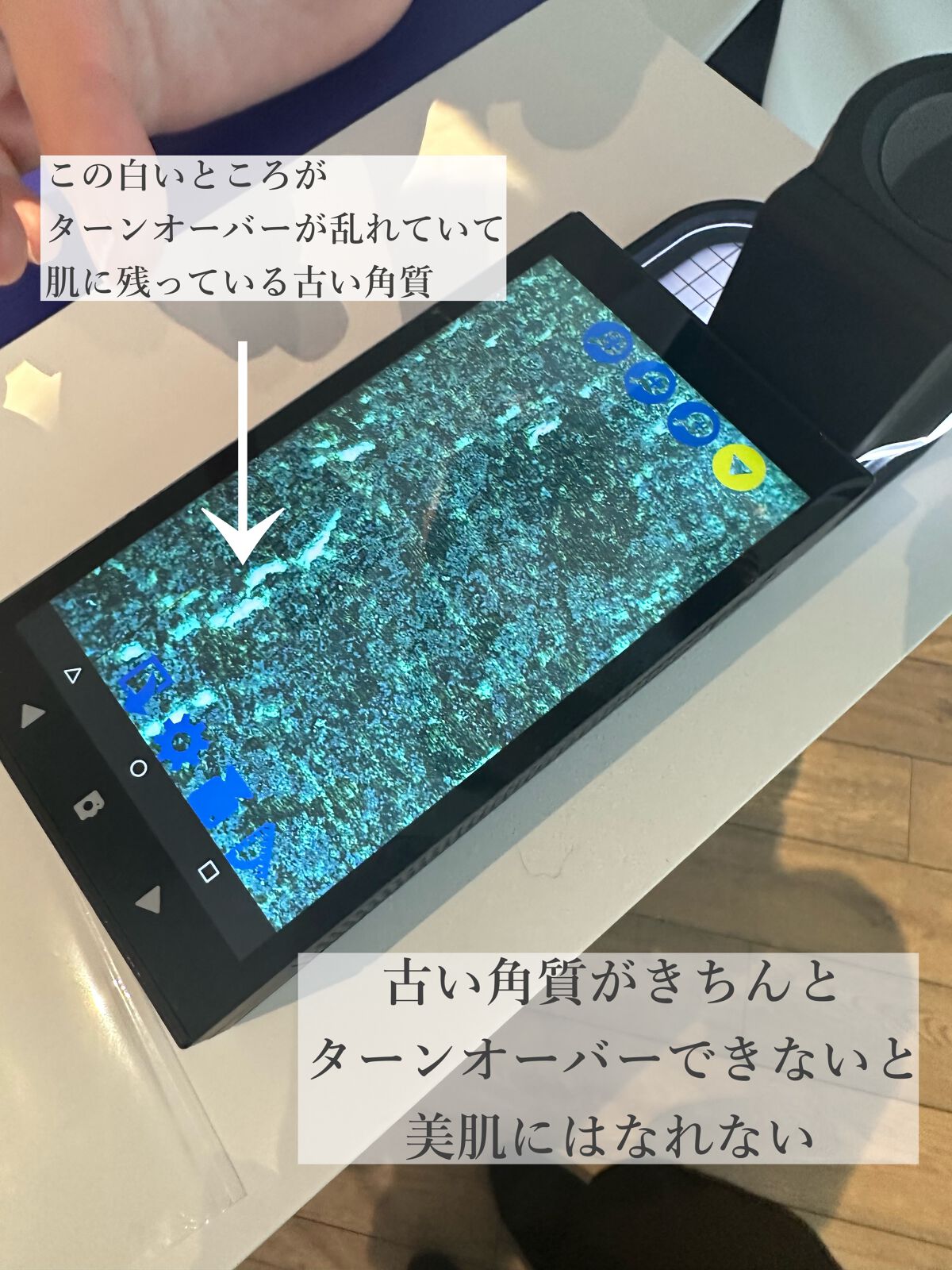 タカミスキンピール/タカミ/ブースター・導入液を使ったクチコミ(2枚目)