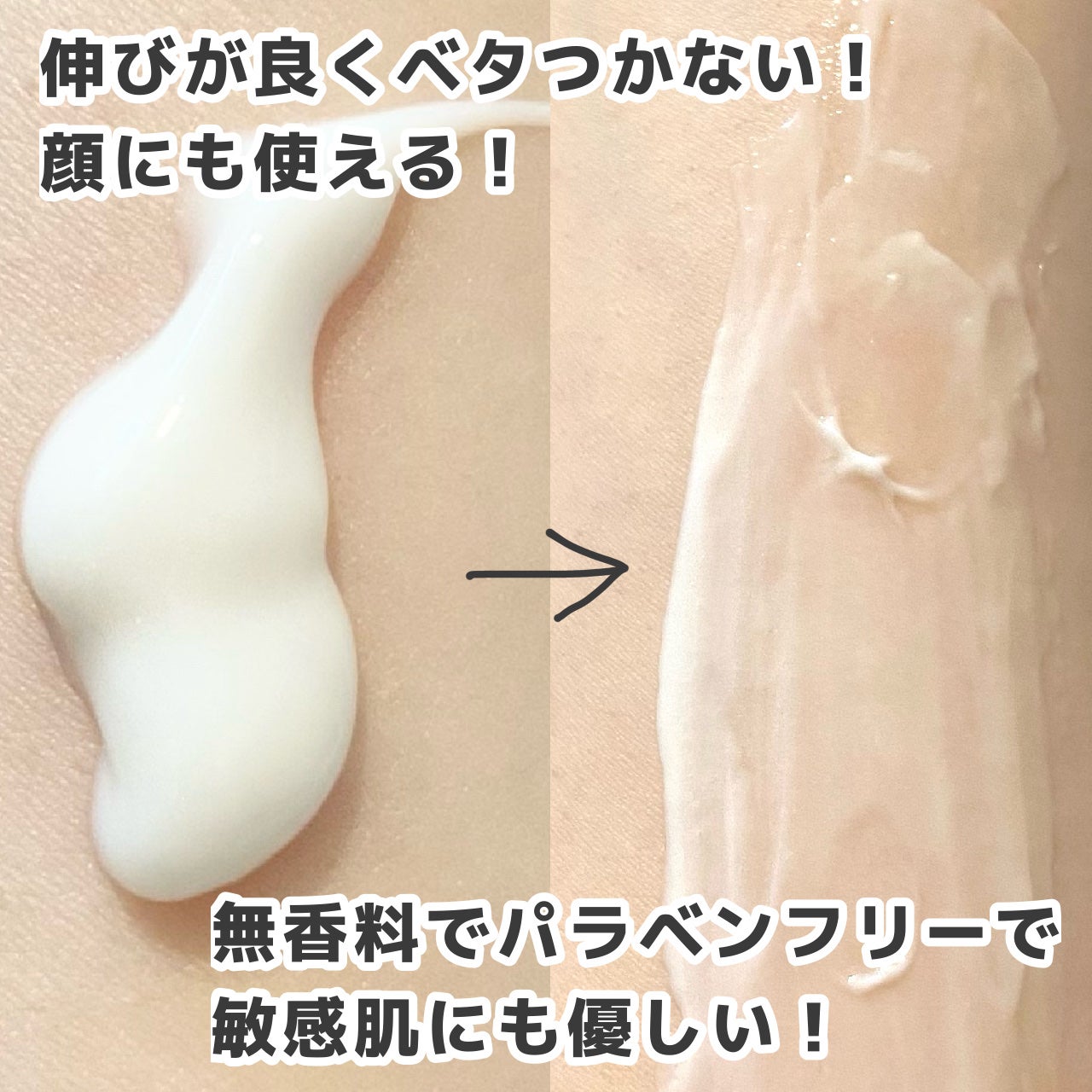 セタフィル モイスチャライジングローション/セタフィル/ボディローションを使ったクチコミ(2枚目)