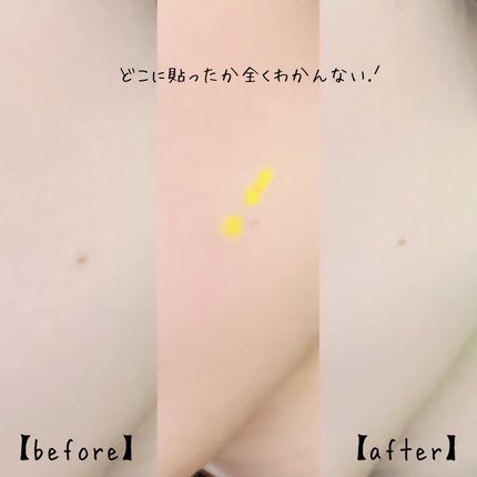 キャッチミーパッチ/CATCH ME PATCH/にきびパッチを使ったクチコミ(4枚目)