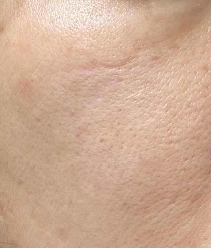 【旧】カプチュール トータル ル セラム/Dior/美容液を使ったクチコミ(3枚目)