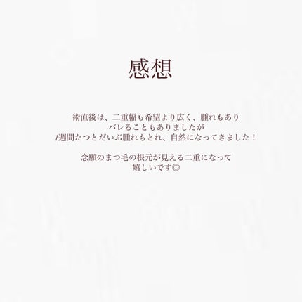 アイトーク/アイトーク/二重まぶた用アイテムを使ったクチコミ(3枚目)