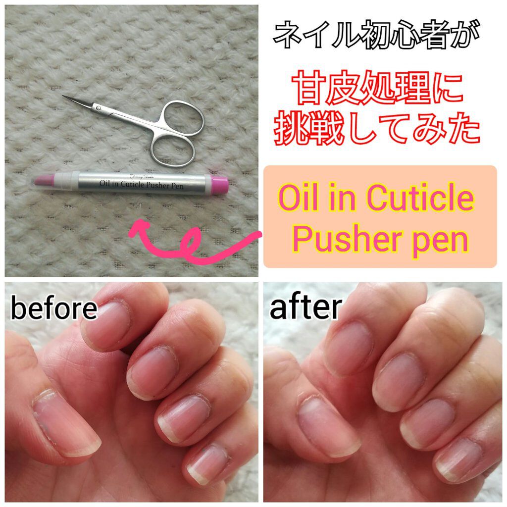 オイルインキューティクルプッシャーペン/ビューティーワールド/ネイル用品を使ったクチコミ(1枚目)