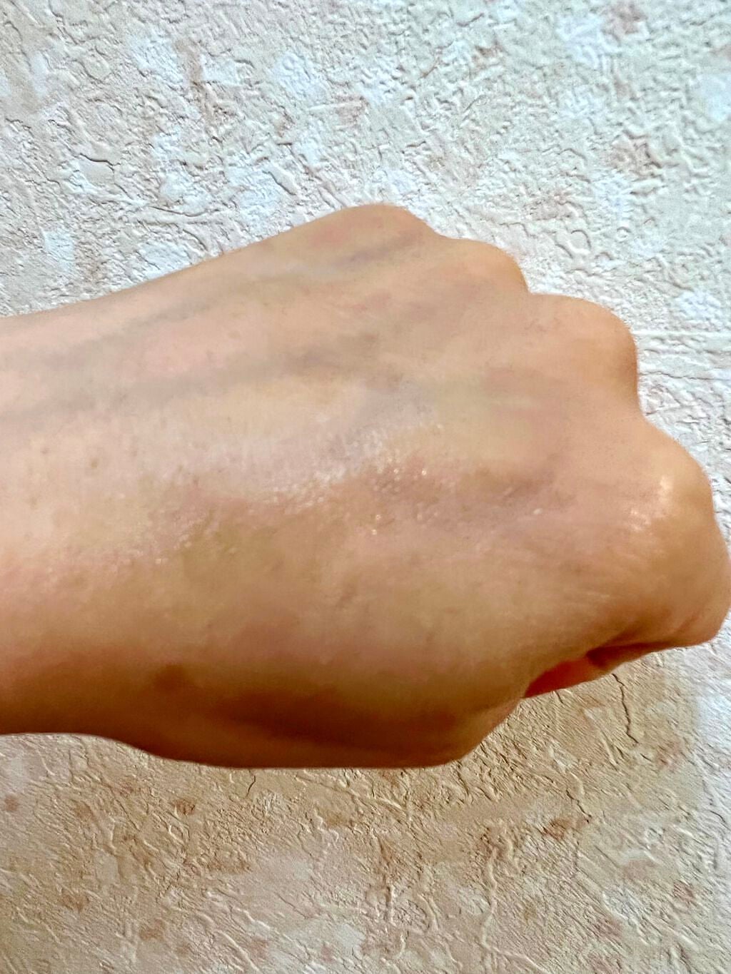 リンクルショット メディカル セラム N/リンクルショット/アイケア・アイクリームを使ったクチコミ(5枚目)