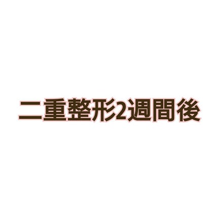 二重整形/その他を使ったクチコミ(1枚目)