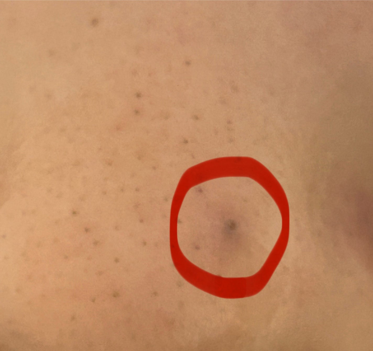 あぼかど on LIPS 「⚠️鼻の黒ずみの写真あります⚠️お目汚しごめんなさい🙇🏻♀️..」(2枚目)