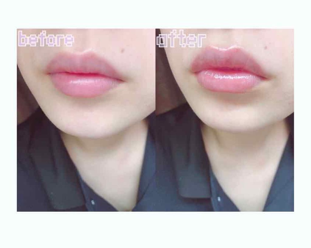 DHC 薬用リップクリーム/DHC/リップクリームを使ったクチコミ(3枚目)