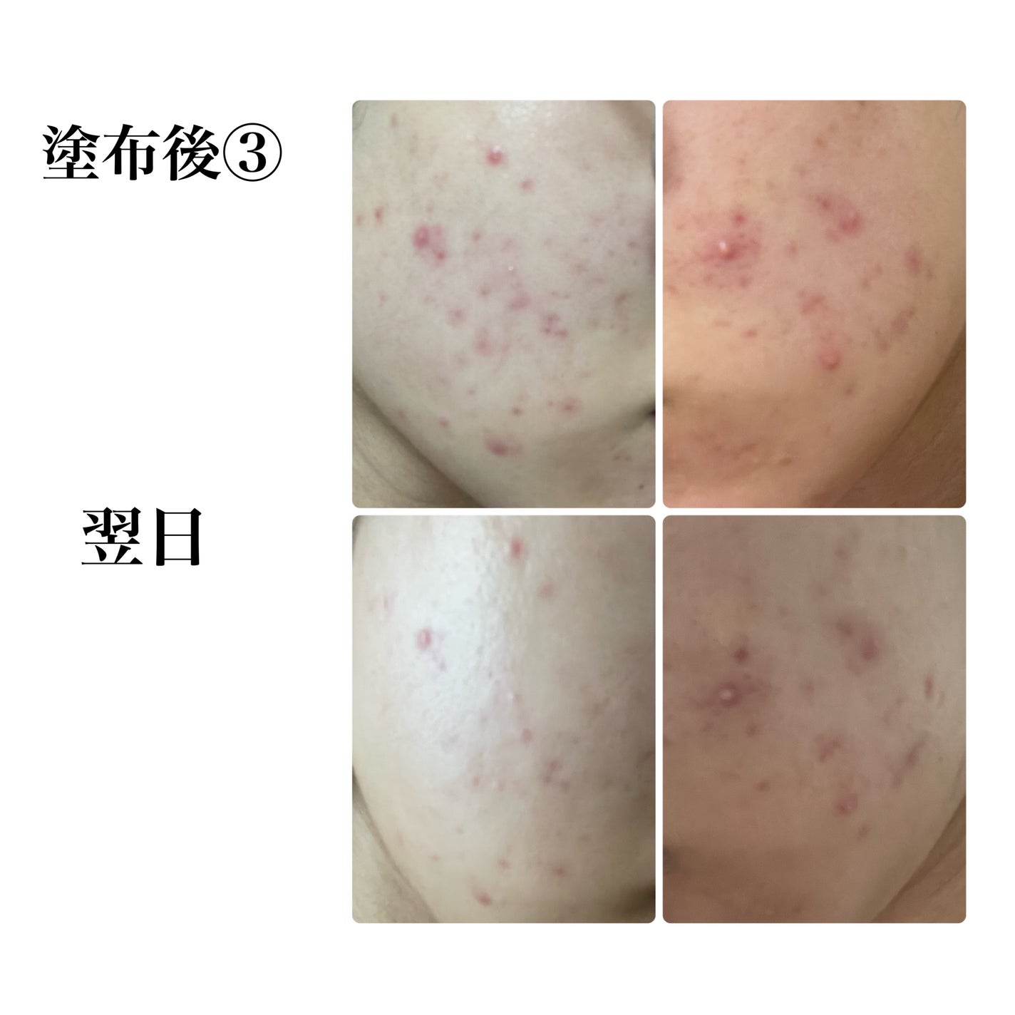 CICA スリーピングマスク/VT/シートマスク・パックを使ったクチコミ(2枚目)