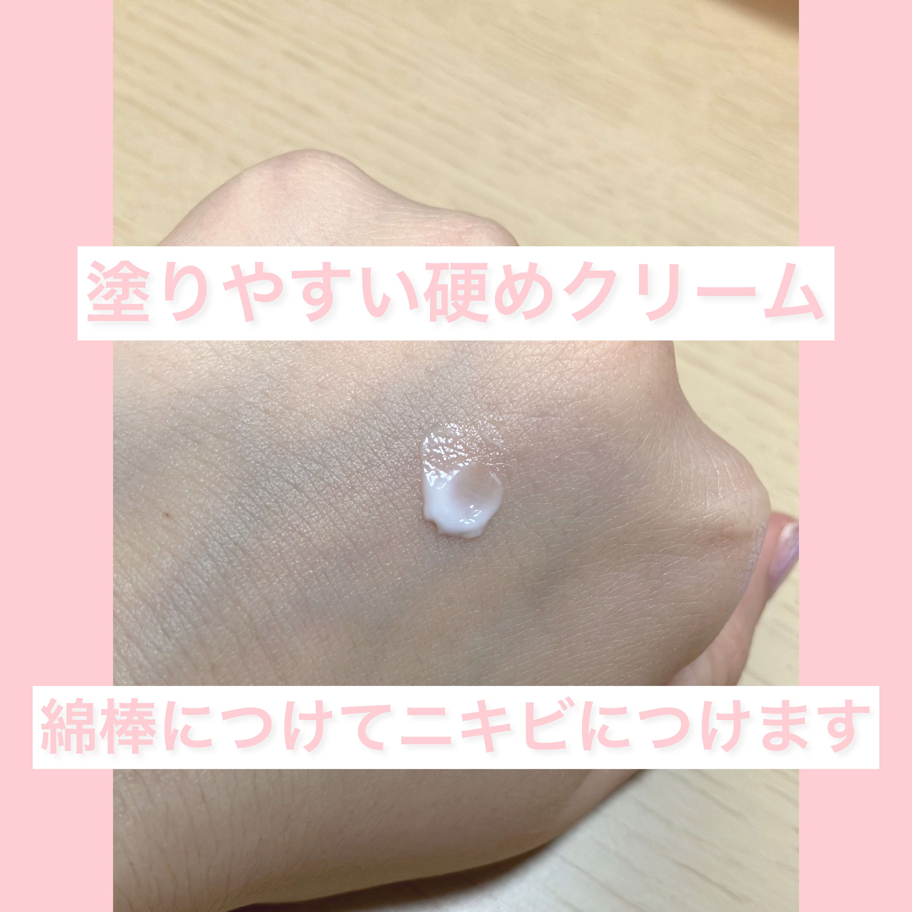 ペアアクネクリームW(医薬品)/ペア/その他を使ったクチコミ（2枚目）