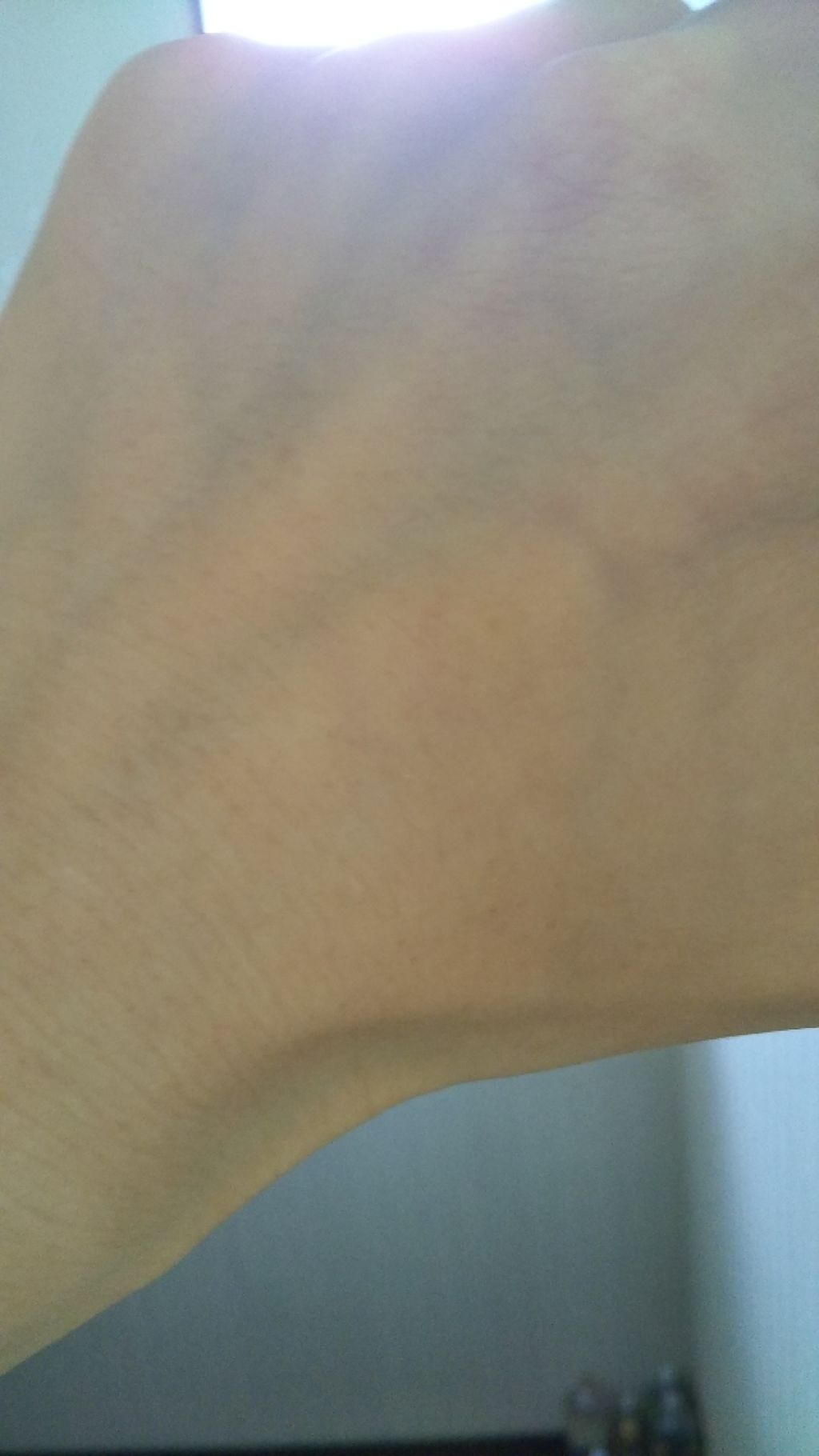 光美容器KE-NON（ケノン）/エムテック/家庭用脱毛器を使ったクチコミ（3枚目）