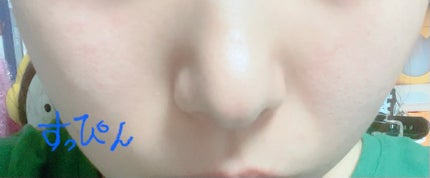 復活草ビフィダセラムファーミングドロップ/Abib /美容液を使ったクチコミ(3枚目)