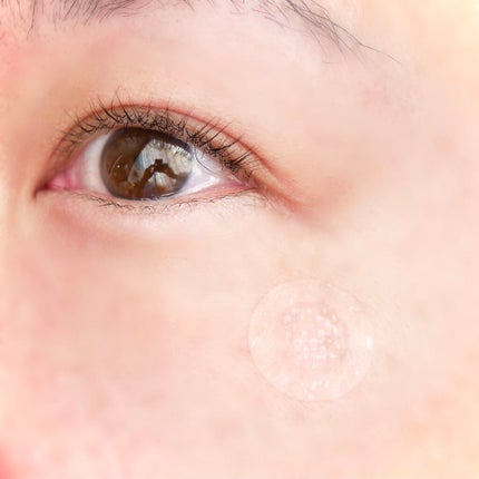 ビタC ディープパッチ/シミウス/シートマスク・パックを使ったクチコミ(7枚目)