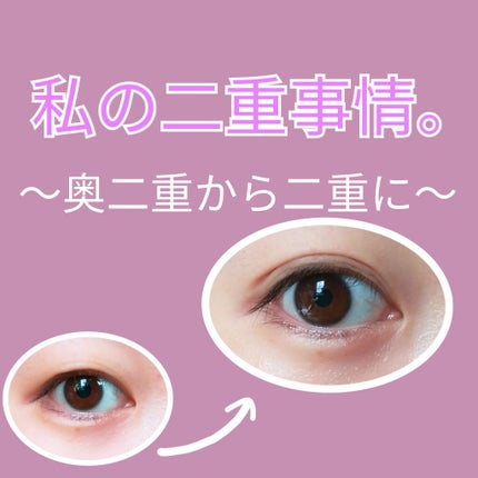 リキッドフィルム/ラクオリ/二重まぶた用アイテムを使ったクチコミ(1枚目)