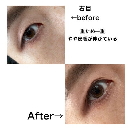 TWOOLダブルアイリッドハイブリットフィルム/SHOBIDO/二重まぶた用アイテムを使ったクチコミ(6枚目)