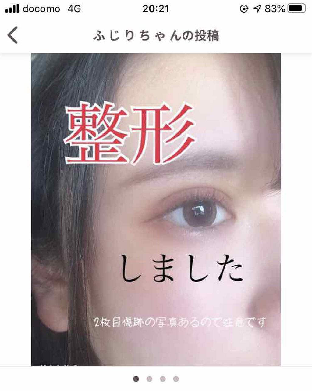 のびる透明アイテープ/キャンドゥ/二重まぶた用アイテムを使ったクチコミ（1枚目）