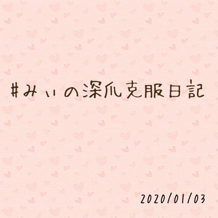 ネイルサポート Na/ネイルネイル/ネイルトップコートを使ったクチコミ(1枚目)