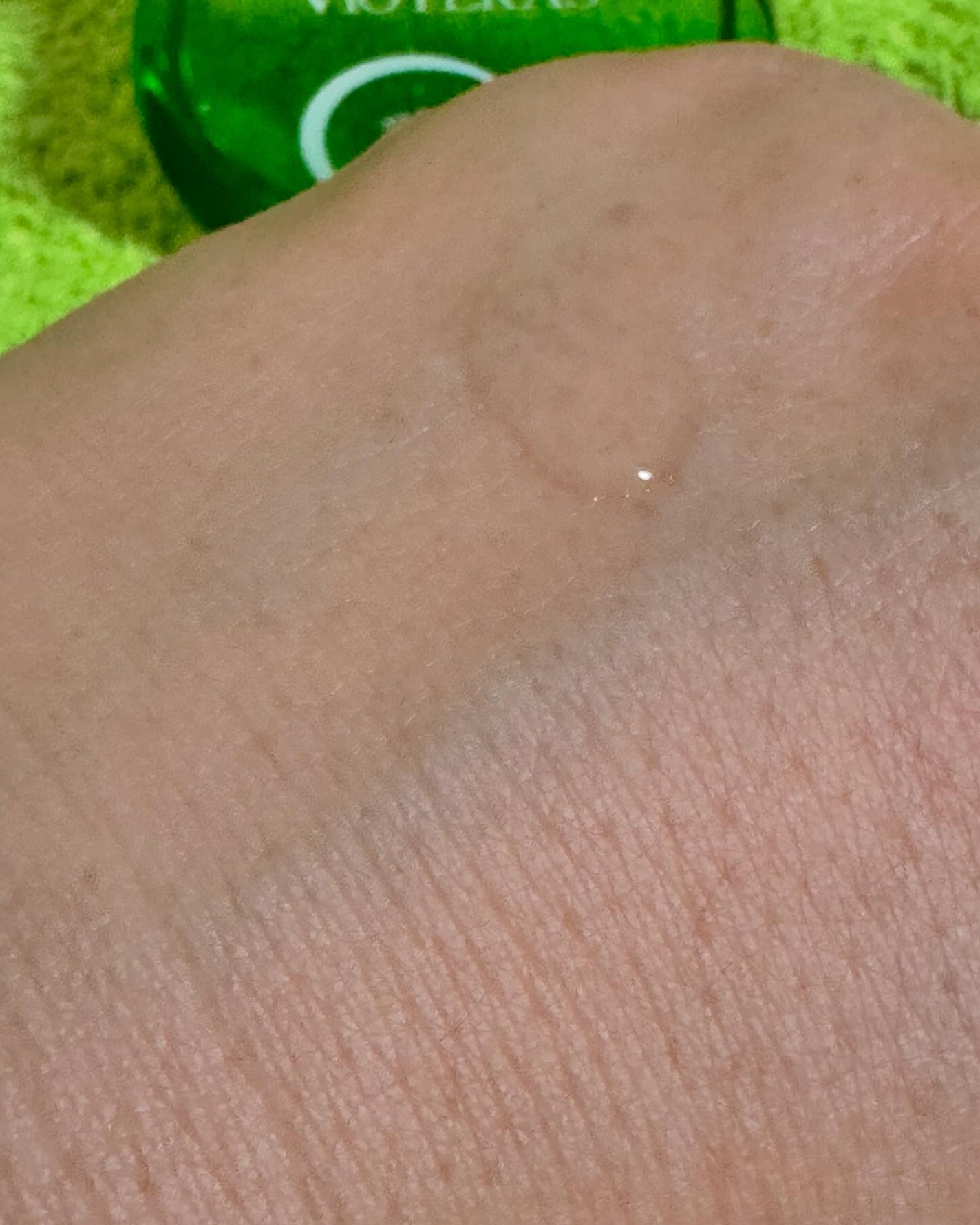 C+クリアセラム/ヴィオテラス/美容液を使ったクチコミ(5枚目)