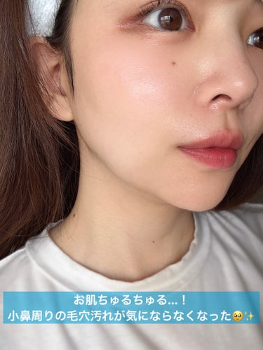 ももか🍑모모가 on LIPS 「この間、初めてハイドラフェイシャルをやってきたのでレポしたいと..」（7枚目）