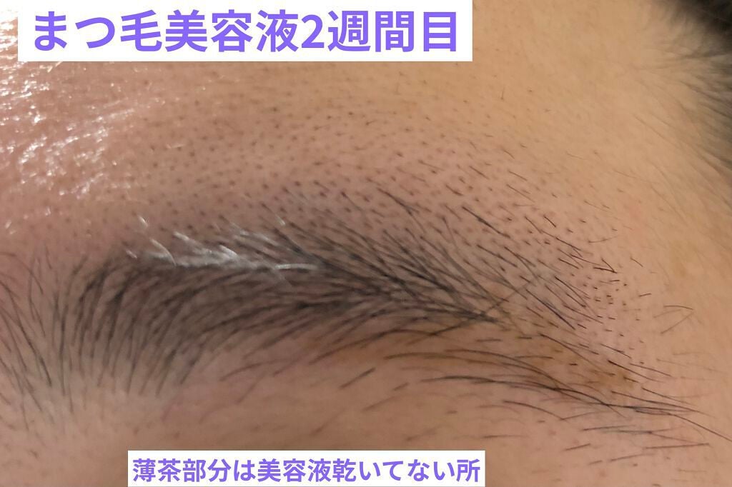 スカルプD ボーテ ピュアフリーアイブロウセラム/アンファー(スカルプD)/その他アイブロウを使ったクチコミ(5枚目)