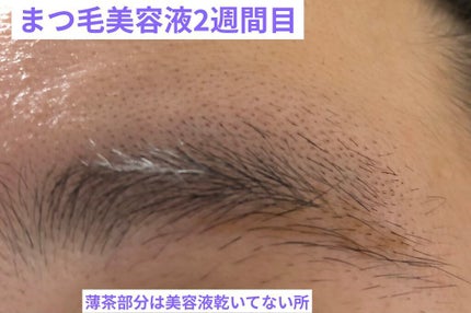 スカルプD ボーテ ピュアフリーアイブロウセラム/アンファー(スカルプD)/その他アイブロウを使ったクチコミ(5枚目)