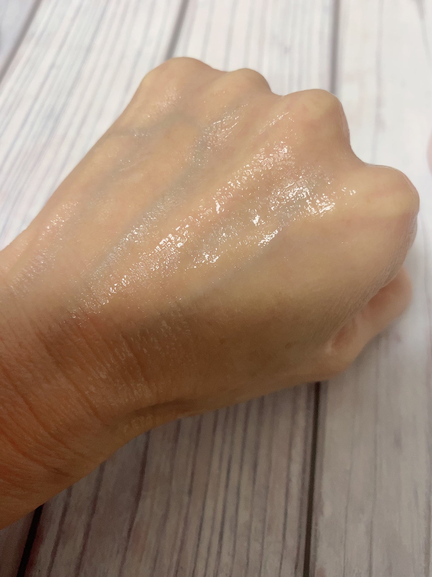 ヒアロワン/キユートピア/オールインワン化粧品を使ったクチコミ(5枚目)