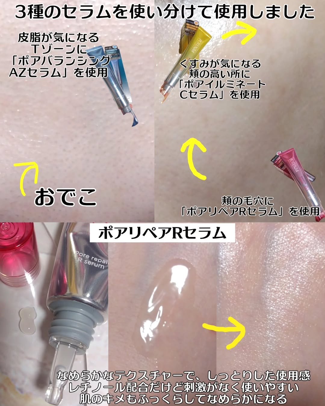 ポテンツェル ポアイルミネートCセラム/POTENZel/美容液を使ったクチコミ（3枚目）