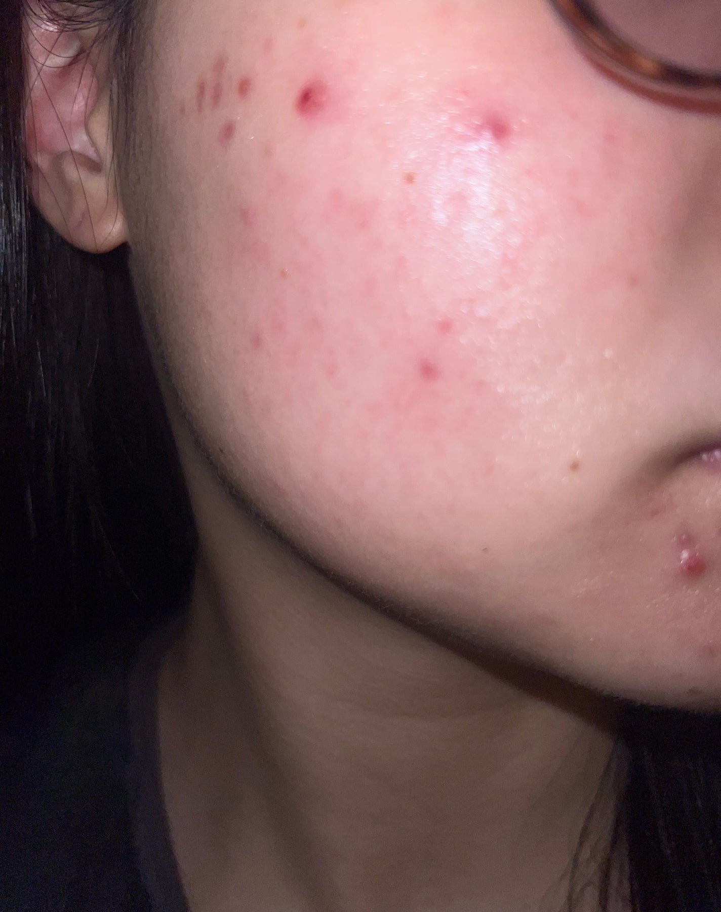 なな on LIPS 「デュアック6日目!!フラッシュがぼやけて上手く撮れない😭😭塗っ..」(1枚目)