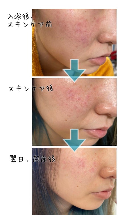 デイリーシカアンプルマスク/TIRTIR(ティルティル)/シートマスク・パックを使ったクチコミ(3枚目)