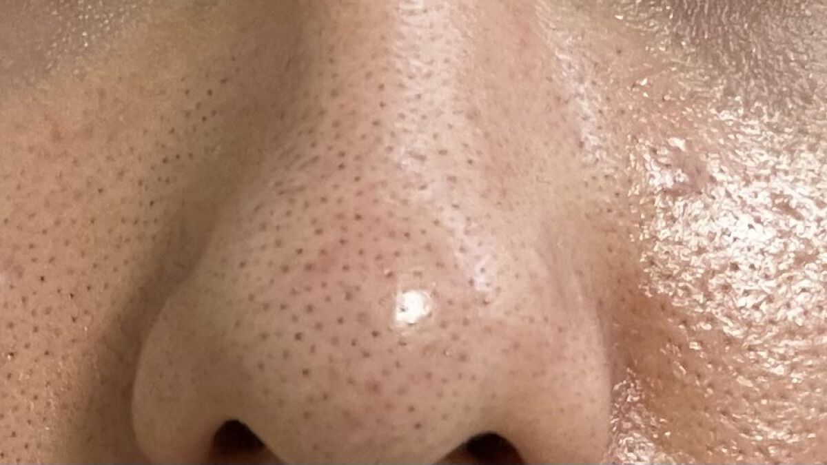 ガラクトミー スキントナー/manyo/化粧水を使ったクチコミ（3枚目）