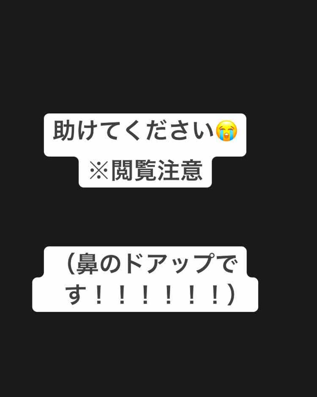 DETクリア ブライト＆ピール ピーリングジェリー <ミックスベリーの香り>/Detclear/ピーリングを使ったクチコミ（1枚目）