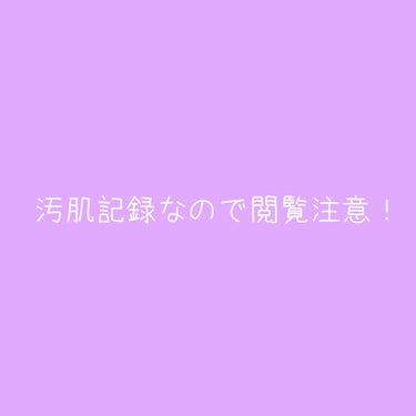 化粧水　敏感肌用　さっぱりタイプ/無印良品/化粧水を使ったクチコミ（2枚目）