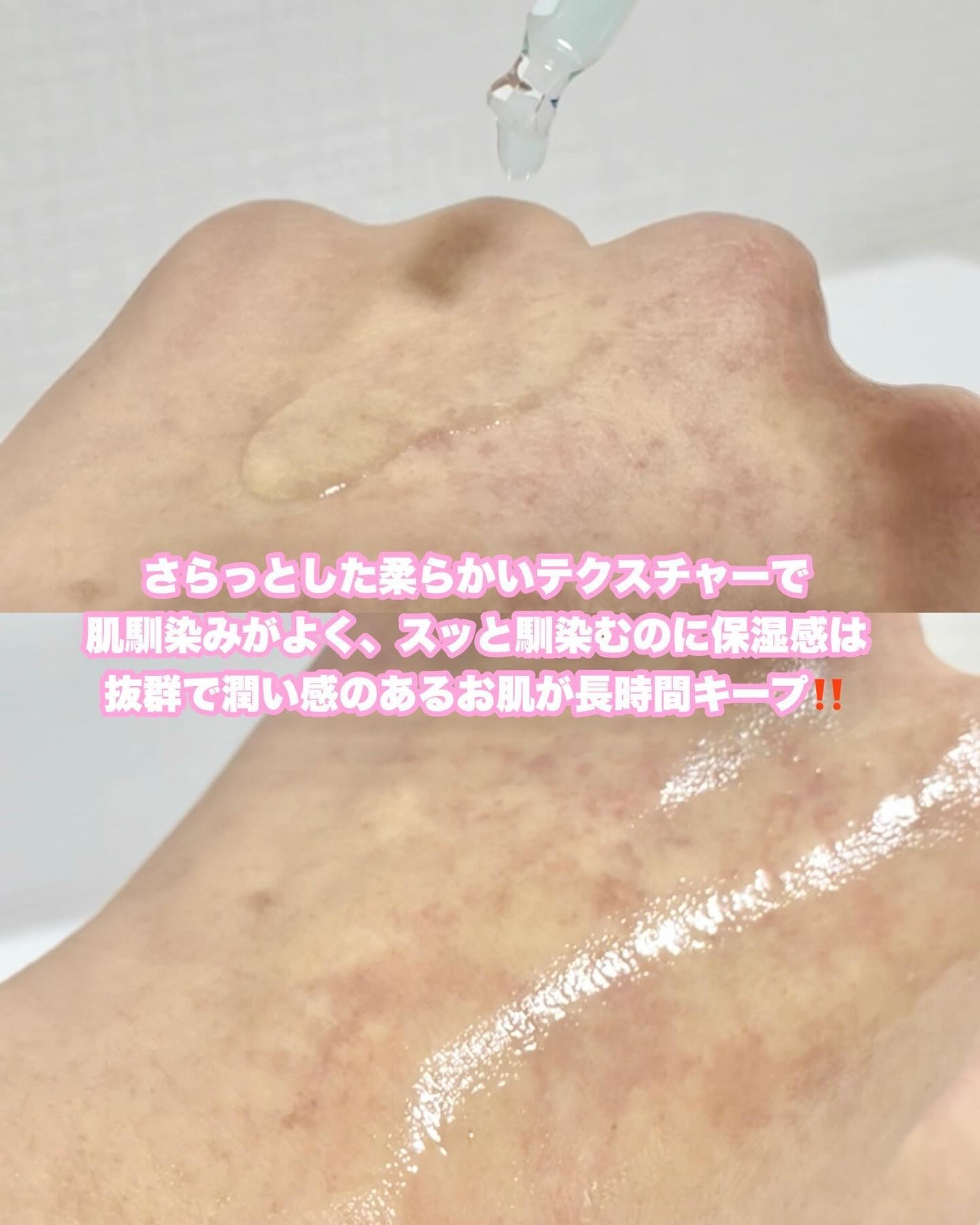 PDRNヒアルロン酸カプセル100セラム/Anua/美容液を使ったクチコミ(5枚目)